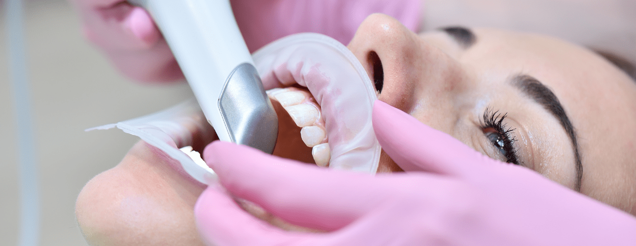 Intraoral Scanning Dentistry