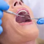 oral cancer screening