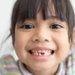 why do we have baby teeth